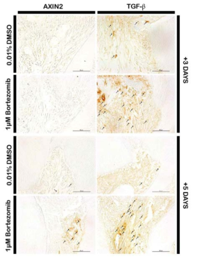 Immunolocalization patterns of Axin2 and TGF-β on 3 and5 days after cavity preparation. Arrows indicate positivelocalization. Scale bars: 50 μm