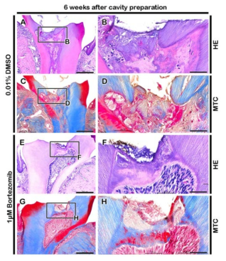 Histological examinations 42 days after cavity preparation showing formation of dentin bridge. (A, B, E, and F) HE staining. (C, D, G, and H) Masson’s trichrome staining. Scale bars A, C, E, and G: 200 μm; B, D, F, and H: 50 μm