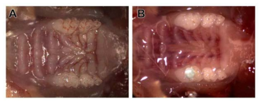 Baseline에서의 pulpal cavity prepration (A), 6주 경과시 약재와 전달체를 보호하고 있는 수복재가 미세누출이나 유출 없이 잘 유지되고 있는 사진 (B)