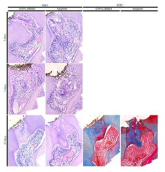 Apigenin 처리 후의 tertiary dentin formation 관찰. H&E staining 및 MTC staining