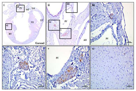 정상 마우스의 심장내 신경절에서 Garem1의 면역조직화학염색. i) 심장 조직 전체. ii) 폐정맥 근처에 위치한 신경절 (iii, iv, v)에 특이적으로 발현하는 Garem1. vi) negative control로 이용된 심실 PV: pulmonary vein; LA: left atrium; LV: left ventricle; VS: ventricular septum, RV: right ventricle; AO: aorta