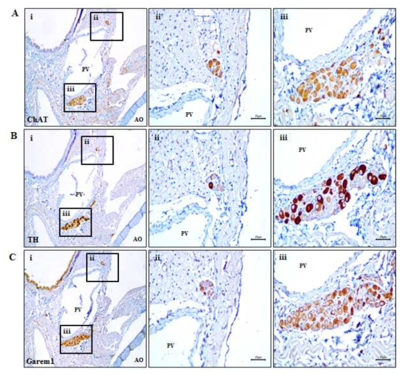 심장내 신경절에서 ChAT, TH, Garem1의 면역조직화학염색. (A) 신경절에서 부교감 신경 세포의 마커인 ChAT의 발현. (B) 신경절에서 교감 신경 세포의 마커인 TH의 발현. (C) 신경절에서의 Garem1 발현. A, B, C – ii, iii는 A, B, C – i (scale bars: 25 μm)을 확대한 사진이며, A, B, C는 serial slide에서 확인. PV: pulmonary vein; LA: left atrium; LV: left ventricle; VS: ventricular septum, RV: right ventricle; AO: aorta