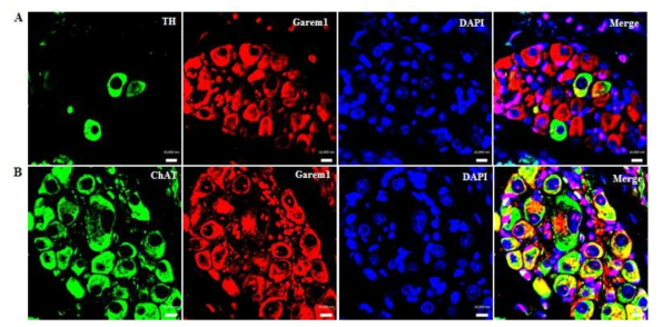 정상 마우스의 심장내 신경절에서 Garem1과 신경 세포 마커 (ChAT 또는 TH)의 공발현 (A) 교감 신경 세포 (TH-녹색)와 Garem1 (빨강)의 공발현. (B) 부교감 신경 세포 (ChAT-녹색)와 Garem1 (빨강)의 공발현