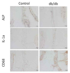일반쥐와 당뇨쥐(db/db mouse)에서 ALP와 파골세포의 발현정도