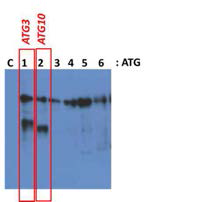 in vitro phosphorylation of autophagy machinery proteins against AMPK, mTORC1, ULK1 kinase complex