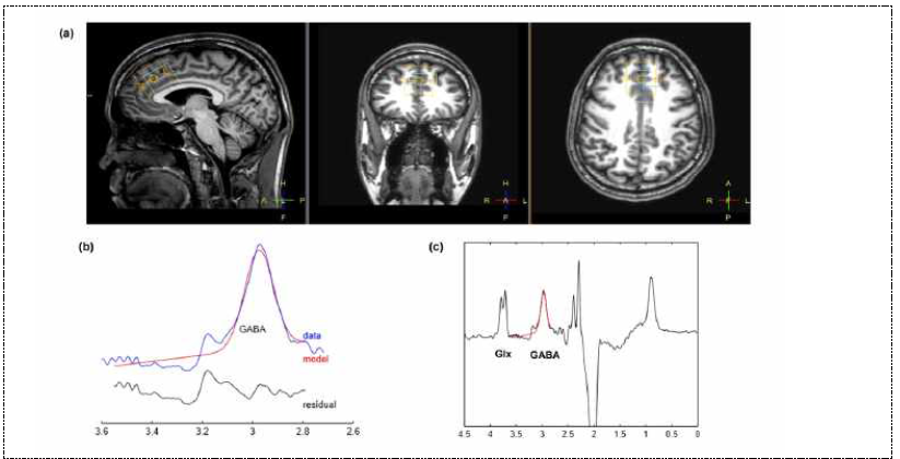 MEGA-PRESS 방법으로 prefrontal area의 GABA 측정 방법론을 확립함. Gannet 2.0 소프트웨어 이용하여 fitting함