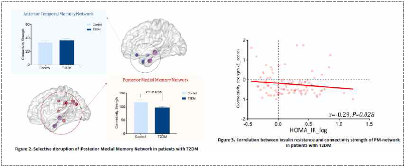 당대사 이상과 연관된 구조적 뇌네트워크 분석을 통해 Posterior medial memory network이 취약함을 발견하였음