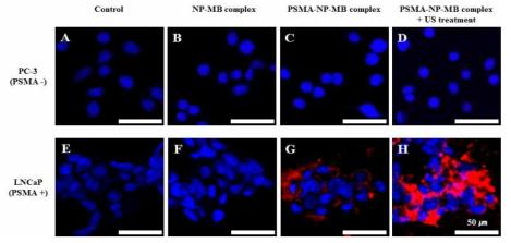 PSMA 타켓팅 펩타이드를 결합한 마이크로 버블-나노입자 복합체의 PSMA 음성 (PC-3) 및 양성 (LNCaP) 세포주에 대한 공초점 주사 현미경 이미지