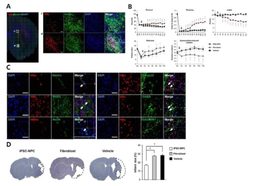 epi-iPSC-NPC의 뇌졸중 동물무델 이식 및 생착, 분화능 분석