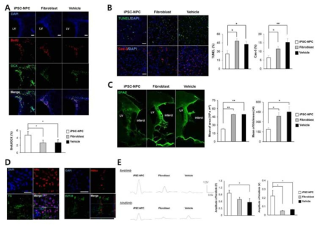 epi-iPSC-NPC 이식 후 뇌졸중 동물모델에서의 신경보호 및 신경기능 회복 분석