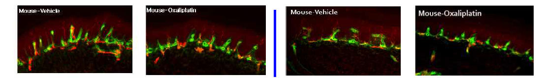 oxaliplatin (10mg/kg) 단회 처치군 (좌) 과 반복처치군(우) 에서의 표피신경 소실