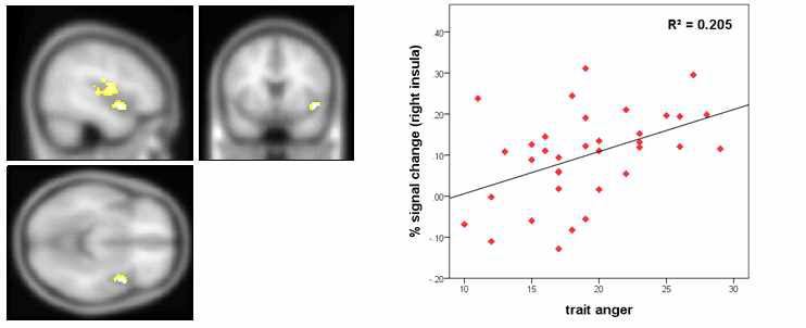 Activity in the right insula, which was positively associated with individual differences in trait anger