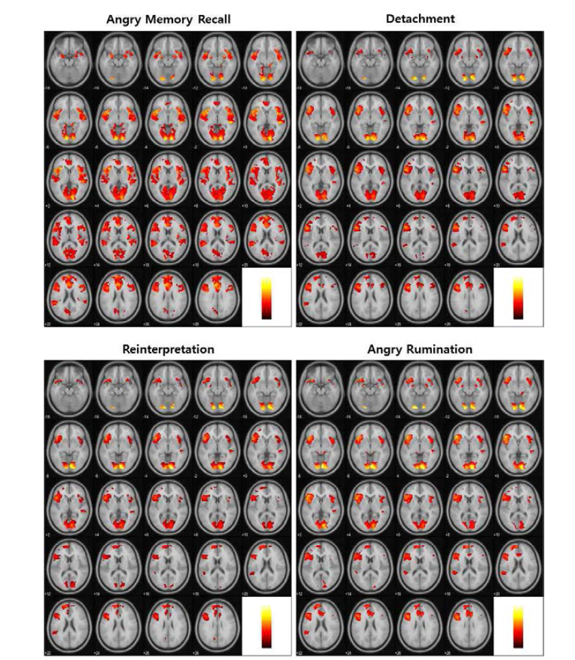 분노 경험 및 조절 전략 별 뇌 활성화