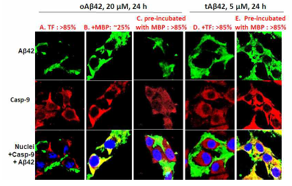 Effect of taiwaniaflavone (TF) and maltose binding protein (MBP) on cellular internalization of Aβ. Cells are treated with 20 μM oAβ42 or 5 μM tAβ42 for 24 h in presence of either 10 μM TF or 0.4 μM MBP. Freshly prepared mixture of peptide and TF were used for the treatment whereas mixture of peptide and MBP with- or without incubation at 37°C for 24 h were used. Confocal microscopic images were visualized by the same way discussed earlier in Fig.2. Incubation At least three independent experiments were carried out and only representative images of cells are displayed here