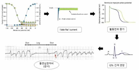 나트륨 이온채널 기능 이상에 의한 치사성 부정맥의 발생 기전