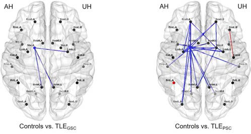 뇌전증 발작의 조절 상태에 따라 구분한 뇌전증 환자(TLEGSC 및 TLEPSC)와 건강한 피험자 (controls) 사이 48개 영역 간 연결성의 효율성 비교. AH, 뇌전증 발작 초점이 위치한 대뇌 반구; UH, 뇌전증 발작 초점의 반대쪽 대뇌 반구