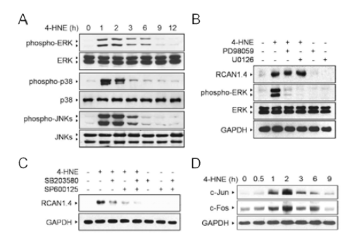 4-HNE에 의한 RCAN1.4의 증가는 JNK-p38 MAPK pathway 의존적