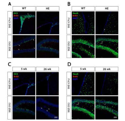 Alpha-synuclein A53T mouse의 neurogenesis 지표 평가