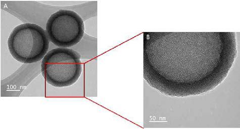 합성한 메조다공성 중공형 실리카 나노물질 TEM 이미지