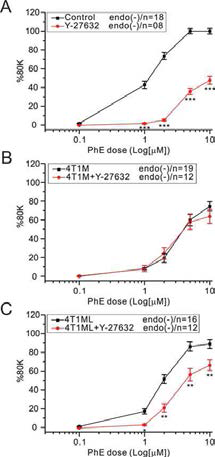 유방암 모델들 간의 Rho-kinase inhibitor반응비교