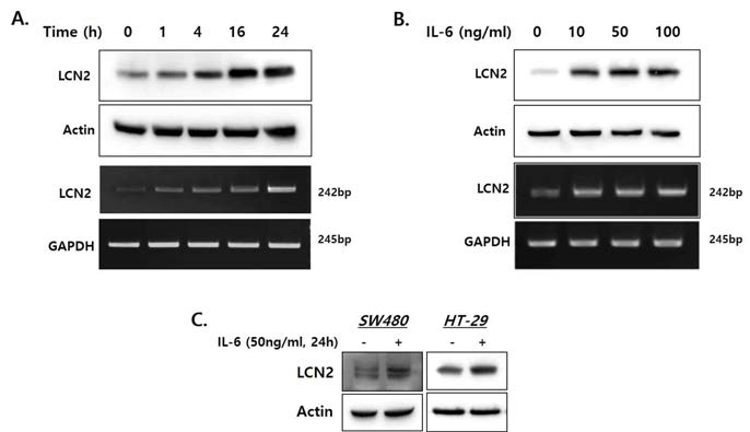 대장 염증 유도 사이토카인 IL-6 처리 후 LCN2의 단백질 및 mRNA 발현 양상 분석. 사람대장암 세포 DLD-1에 50 ng/ml의 IL-6를 투여하고 시간대별로 세포를 lysis 후 단백질과 mRNA를 추출하여 LCN2의 발현을 확인함 (A). DLD-1 세포에 다양한 농도의 IL-6를 처리하고 24시간 후 LCN2 단백질과 mRNA 발현 양상을 확인함 (B). 사람 대장암 세포인 SW480과 HT-29에 50ng/ml의 IL-6를 투여하고 24시간 후 LCN2 단백질 발현 양상을 확인함 (C)