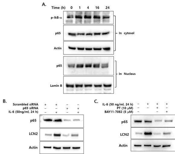 DLD-1세포에 50ng/ml의 IL-6를 투여하고 시간대별 NF-kB 활성의 변화를 확인 (A). NF-kB 활성 억제를 위해 siRNA와 NF-kB inhibitor 사용하여 LCN2 표적 가능성 확인 (B, C)