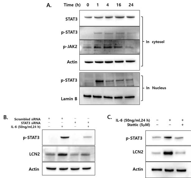 DLD-1세포에 50ng/ml의 IL-6를 투여하고 시간대별 STAT3 활성의 변화를 확인 (A). STAT3 활성 억제를 위해 siRNA와 STAT3 specific inhibitor 사용하여 LCN2 표적 가능성 확인 (B, C)