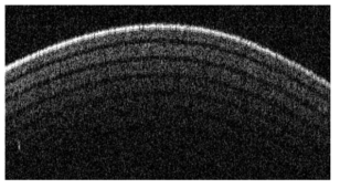 구현된 prototype 이용한 multi-layered polymer film(접착용 테이프)의 단면 영상(lateral scan range = 10 mm)