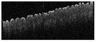 인체 피부 조직(hand skin)에서의 단면 영상(lateral scan range = 10 mm)