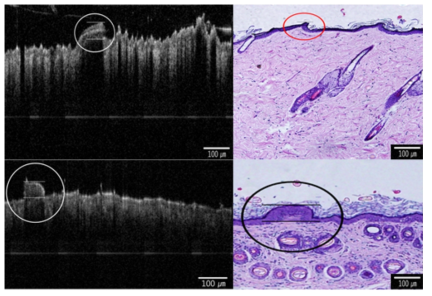 OCT 프로토타입 이용하여 획득한 기니피그 동물 모델의 비정사 피부조직 이미지(좌)와 동일한 위치의 병리조직 이미지(우)