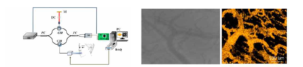 Schematic diagram of SS-OCT system; 구강 혀의 표면 capillaroscopy 결과와 OCT based angiography