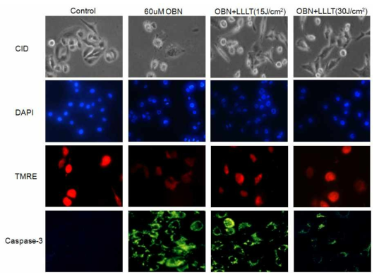 Ouabain 처리 후 광 조사에 의한 핵내 세포고사 확인(DAPI)과 마이토콘드리아 내 전위막 활성도 검사(TMRE), 세포고사 마커인 Caspase-3 분석