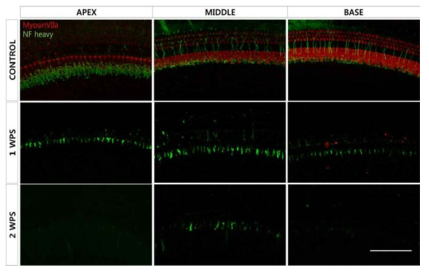 수술 전후 면역형광염색(Scale bar: 100 ㎛, MyosinVIIa: hair cell marker)