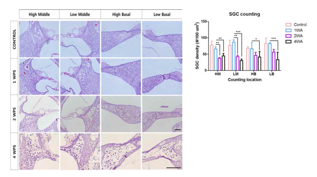 Gelfoam 처리 수술 후 청각 신경세포의 변화