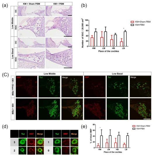 이차성 청신경 손상모델에서 PBM 적용 후 조직학적 평가. (a) 청신경 세포 H&E 염색 결과 (b) 청신경 세포 양적 측정 (c) MBP와 TuJ의 면역형광염색 결과 (d) 청신경세포 myelination 점수화 (e) 청신경세포 myelination의 양적 측정