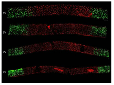 연골손상의 정도의 confocal microscopic image를 통한 평가 (Live and dead staining)