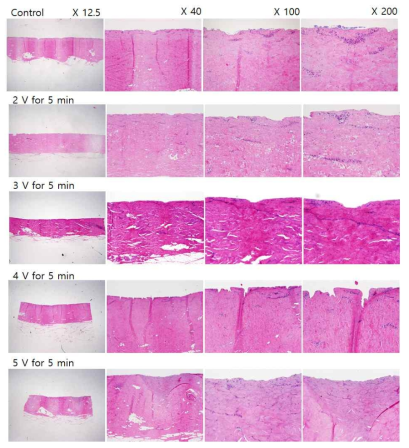 전압 변화에 따른 ECT 처리(5분)후 각 조직의 H&E 염색 결과