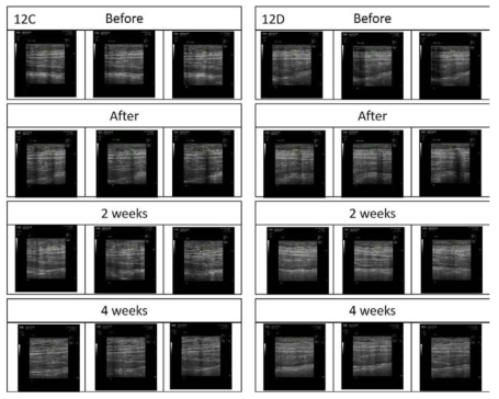 돼지의 12C와 12D site의 ECT 적용(1 mA/5 min) 전후 및 2, 4 주차 초음파 이미지