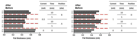 ECT 적용 전후 초음파를 이용한 지방 두께 변화 측정 결과
