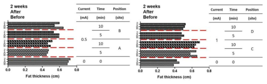 ECT 적용 전후 그리고 2주 후 초음파를 이용한 지방 두께 변화 측정 결과