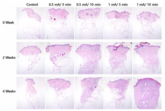 ECT 적용 전후 그리고 2, 4주 후 H&E 염색을 통한 돼지 지방 조직 변화 관찰