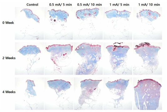 ECT 적용 전후 그리고 2, 4주 후 Masson Trichrome (MT) 염색을 통한 돼지 지방 조직 변화 관찰