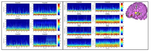 (좌측 상자; 좌측-해마, 우측-피질 전극) 프로포폴 농도 변화시 시간-주파수 특성 (우측 상자; 좌측-해마, 우측-피질 전극) 상태별 시간-주파수 특성 및 피질 전극 위치 (노란색 동그라미)