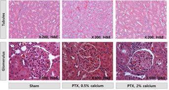 신장 세뇨관 및사구체의 조직학적 소견. 신장독성의 소견은 관찰되지 않음