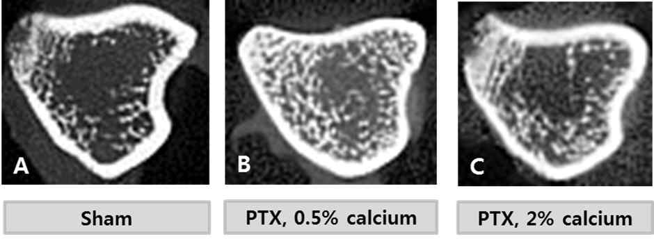 Tibia bone의 micro CT 소견 및 수치. PTX 군은 뼈 흡수의 감소로 대조군에 비해 모두 bone volume이 증가함