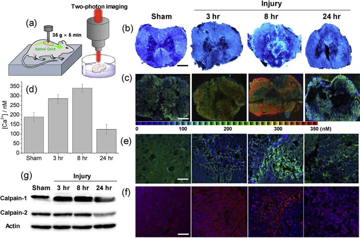 척추 손상을 발생시킨 쥐의 조직을 이용한 칼슘이온 농도 변화 관찰