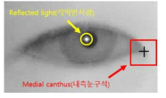 검출된 내측 눈구석(medial canthus) 및 각막반사광(reflected light)의 예