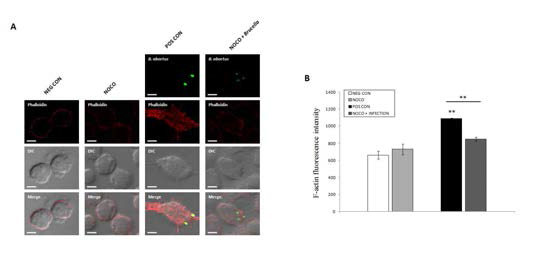 Effect of nocodazole on F-actin polymerization in macrophages upon B. abortus uptake