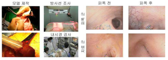 Rebamipide 투여 전후 방사선 조사된 장 점막 비교