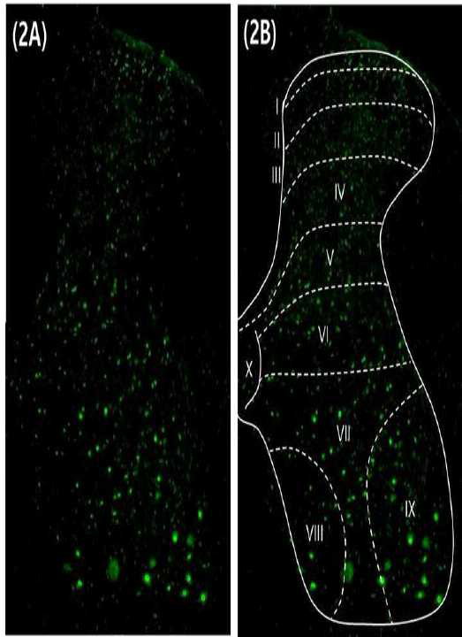 Mincle expression in the lumbar spinal cord